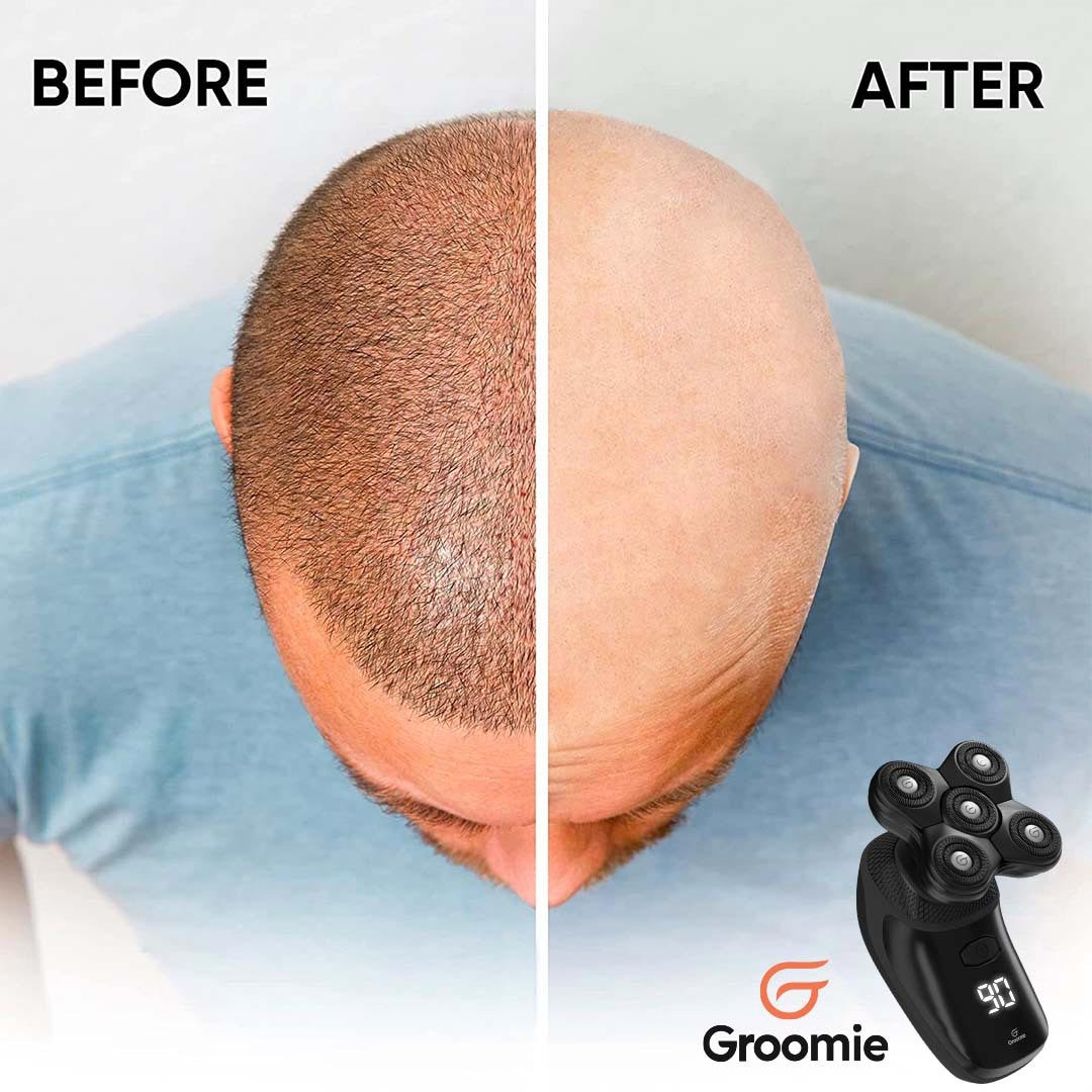 BaldiePro™ Head & Body Shaver - Image 3